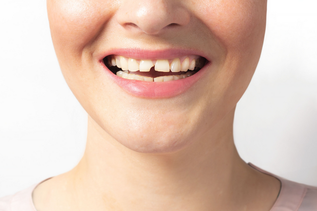 restorative dentistry in spruce grove