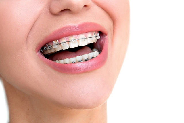 orthodontics in spruce grove