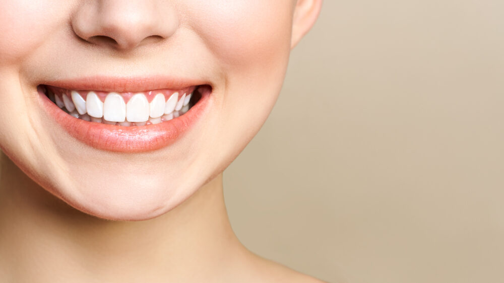 what you need to know about teeth whitening