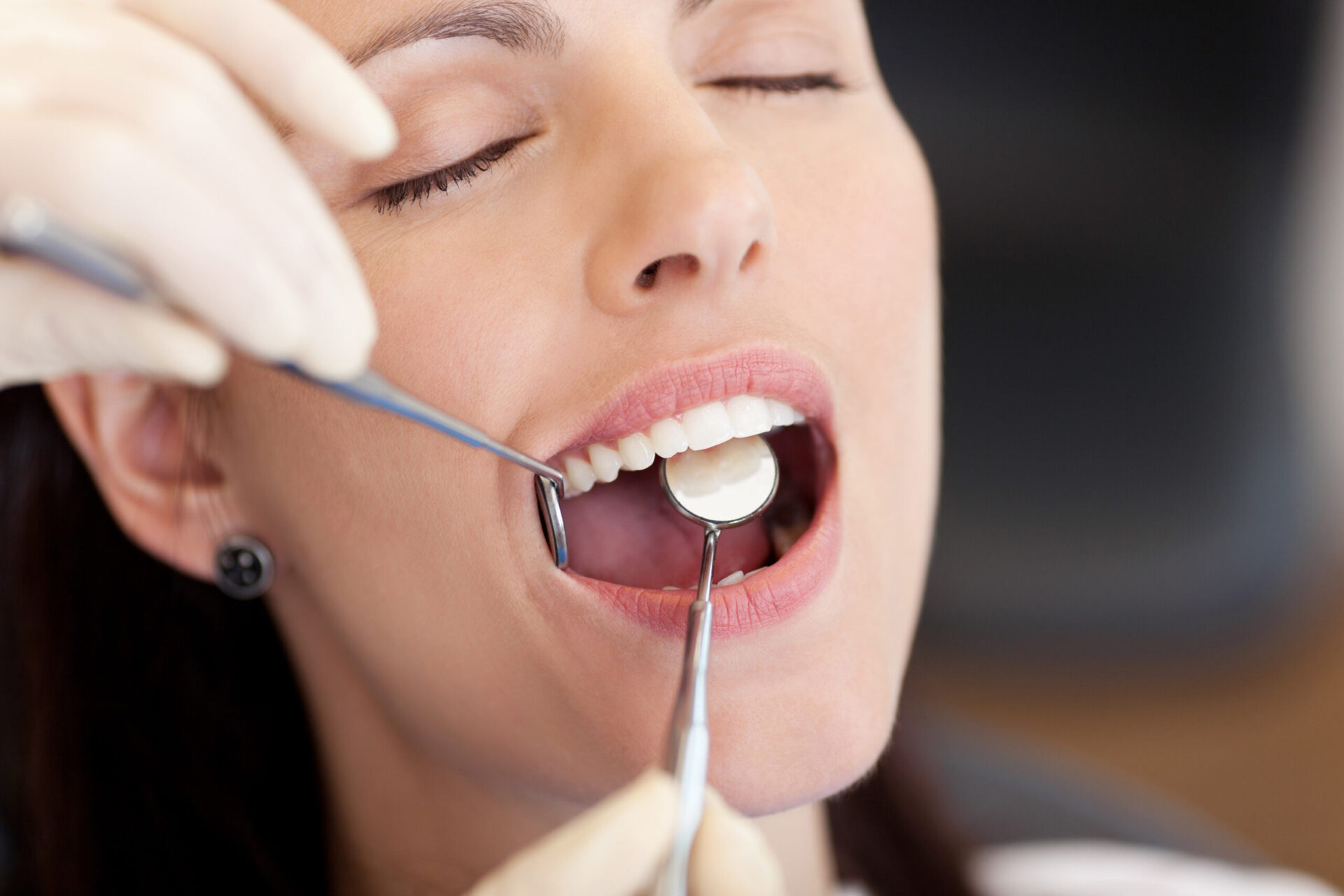 The Benefits of Sedation Dentistry