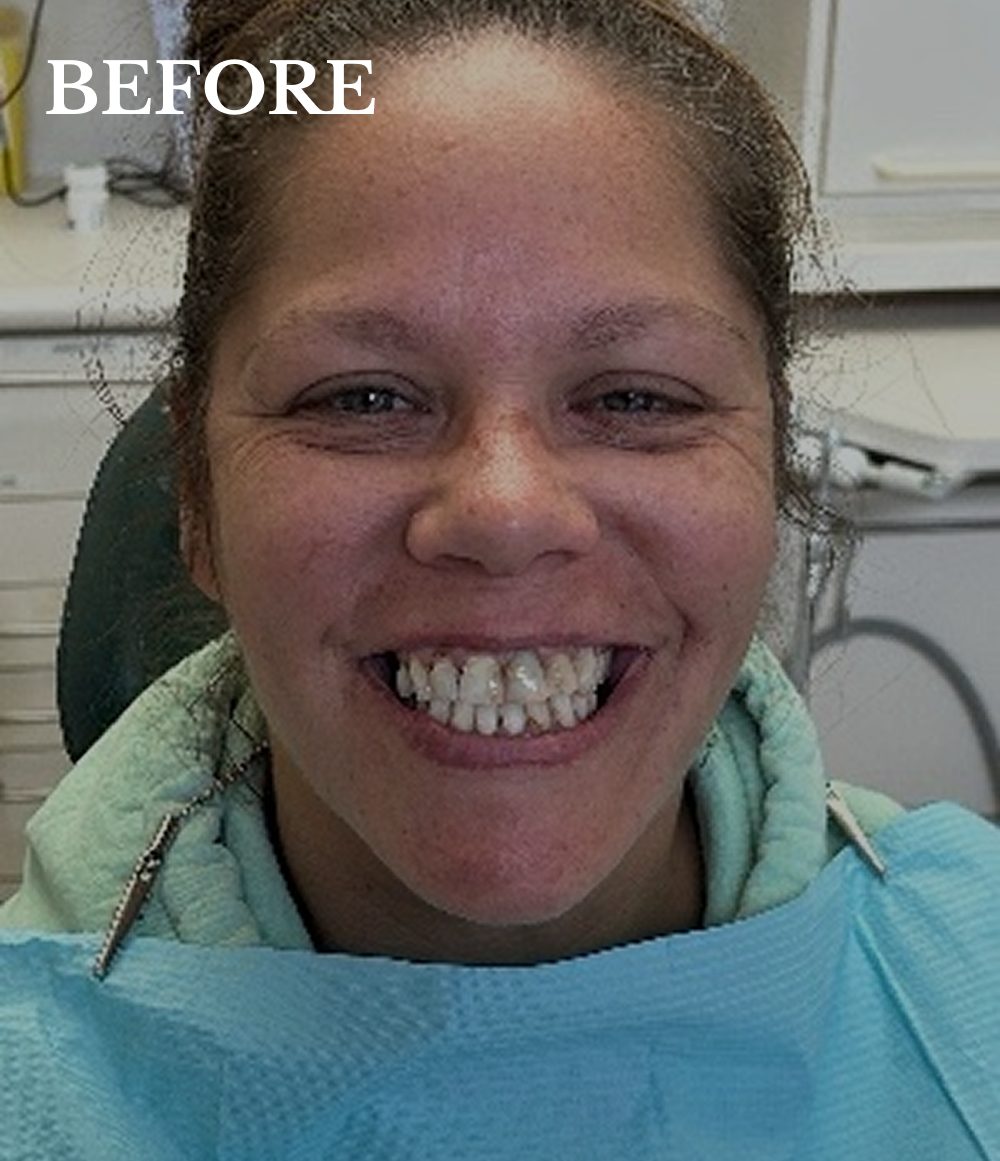 Ronita Case before