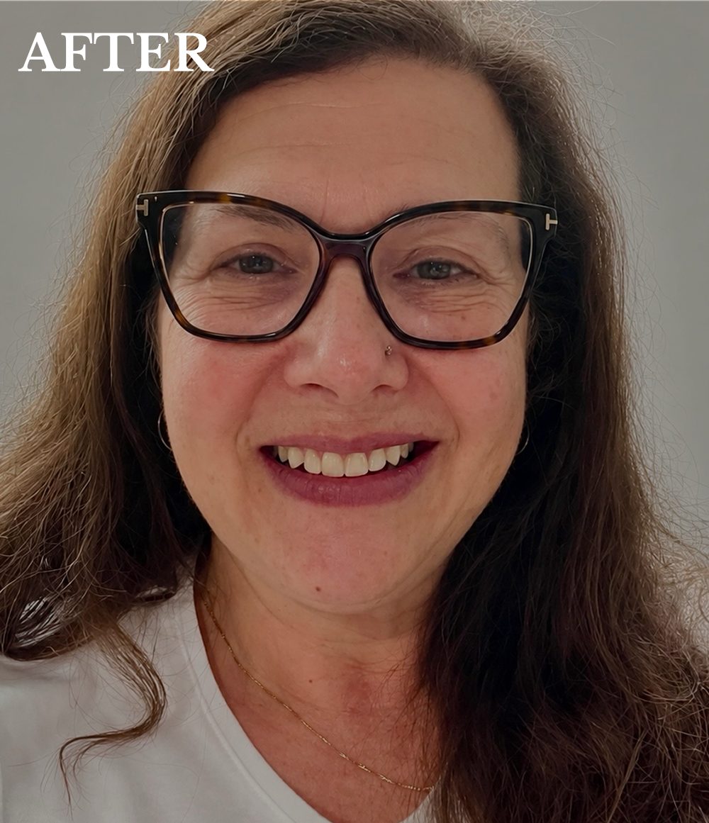 Tracey after