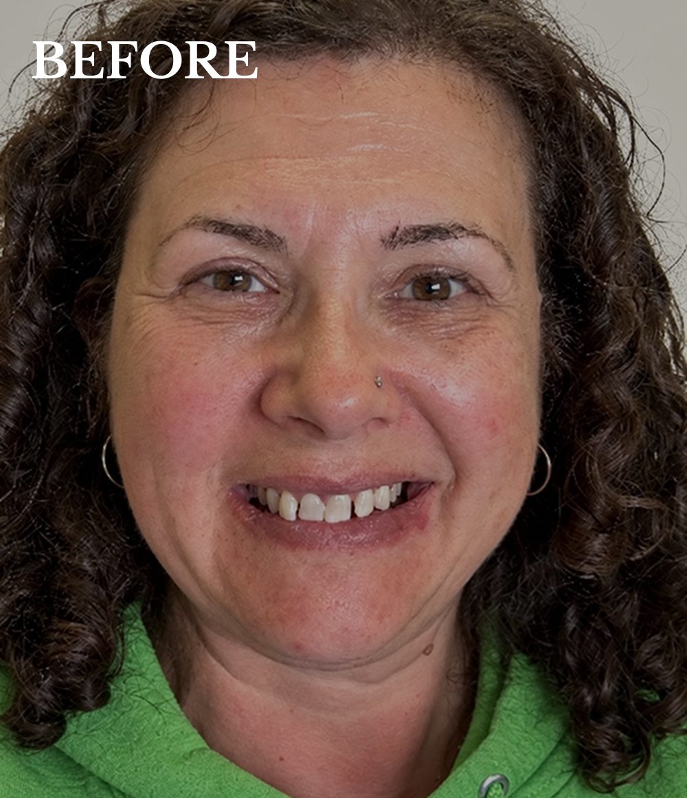 Tracey before